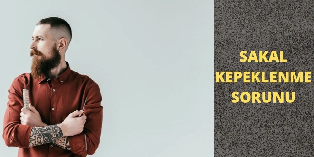 Sakal Kepeklenme Sorununu Nasıl Çözeriz ?